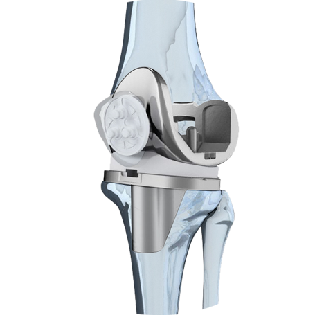 protesis rodilla3 bicos